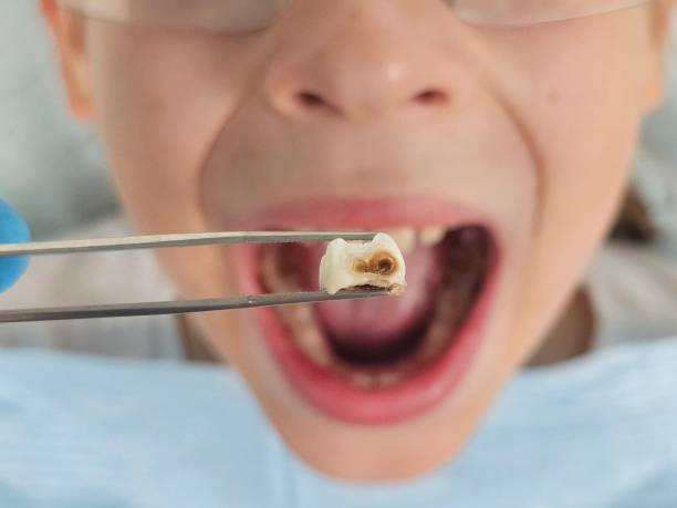 Best Tooth Infection Emergency Dentist  in Kirby, TX